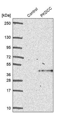 Anti-PKDCC antibody produced in rabbit Prestige Antibodies&#174; Powered by Atlas Antibodies, affinity isolated antibody, buffered aqueous glycerol solution, ab2