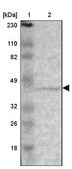 Anti-ZNF222 antibody produced in rabbit Prestige Antibodies® Powered by Atlas Antibodies, affinity isolated antibody, buffered aqueous glycerol solution