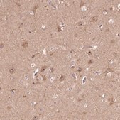 Anti-PARP3 antibody produced in rabbit Prestige Antibodies&#174; Powered by Atlas Antibodies, affinity isolated antibody, buffered aqueous glycerol solution