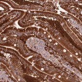 Anti-LPIN2 antibody produced in rabbit Prestige Antibodies&#174; Powered by Atlas Antibodies, affinity isolated antibody, buffered aqueous glycerol solution