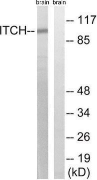Anti-ITCH antibody produced in rabbit affinity isolated antibody