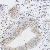 Anti-AKT1 antibody produced in rabbit