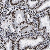 Anti-RBL2 antibody produced in rabbit Prestige Antibodies&#174; Powered by Atlas Antibodies, affinity isolated antibody, buffered aqueous glycerol solution