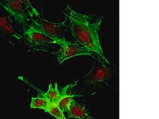 Anti-JMJD4 (NT) Antibody from rabbit