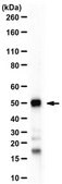 Anti-Histone-lysine N-methyltransferase SUV39H2 Antibody from rabbit, purified by affinity chromatography