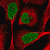 Anti-SIK3 antibody produced in rabbit Prestige Antibodies&#174; Powered by Atlas Antibodies, affinity isolated antibody, buffered aqueous glycerol solution