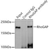Anti-RhoGAP Antibody, clone 3L9I3, Rabbit Monoclonal