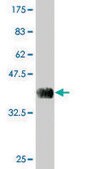 Monoclonal Anti-PRSS27 antibody produced in mouse clone 6F11, purified immunoglobulin, buffered aqueous solution