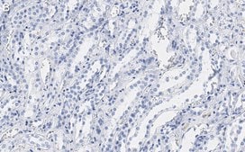 Anti-CDC5L Antibody, clone 4F8 ZooMAb&#174; Rabbit Monoclonal recombinant, expressed in HEK 293 cells