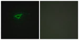 Anti-Collagen XX &#945;1 antibody produced in rabbit affinity isolated antibody