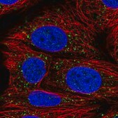 Anti-AACS antibody produced in rabbit Prestige Antibodies&#174; Powered by Atlas Antibodies, affinity isolated antibody, buffered aqueous glycerol solution