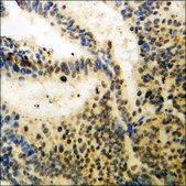 Anti-phospho-B-RAF (pSer446) antibody produced in rabbit affinity isolated antibody
