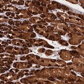 Anti-CEP44 antibody produced in rabbit Prestige Antibodies® Powered by Atlas Antibodies, affinity isolated antibody, buffered aqueous glycerol solution