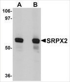 Anti-SRPX2 antibody produced in rabbit affinity isolated antibody, buffered aqueous solution