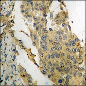 Anti-phospho-PAK3 (pSer154) antibody produced in rabbit affinity isolated antibody