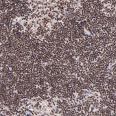 Anti-ZFX antibody produced in rabbit Prestige Antibodies&#174; Powered by Atlas Antibodies, affinity isolated antibody, buffered aqueous glycerol solution