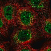 Anti-NDUFB6 antibody produced in rabbit Prestige Antibodies&#174; Powered by Atlas Antibodies, affinity isolated antibody, buffered aqueous glycerol solution