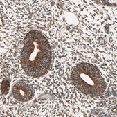 Anti-P4HA1 antibody produced in rabbit Prestige Antibodies&#174; Powered by Atlas Antibodies, affinity isolated antibody, buffered aqueous glycerol solution