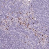 Anti-CENPM antibody produced in rabbit Prestige Antibodies® Powered by Atlas Antibodies, affinity isolated antibody, buffered aqueous glycerol solution