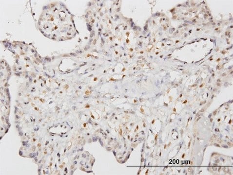 Monoclonal Anti-STK33 antibody produced in mouse clone 3F10, purified immunoglobulin, buffered aqueous solution