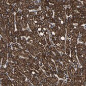 Anti-ETFA antibody produced in rabbit Prestige Antibodies&#174; Powered by Atlas Antibodies, affinity isolated antibody, buffered aqueous glycerol solution