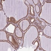 Anti-LARS antibody produced in rabbit Prestige Antibodies® Powered by Atlas Antibodies, affinity isolated antibody, buffered aqueous glycerol solution