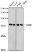 Anti-EXOSC7 Antibody, clone 0B8G6, Rabbit Monoclonal