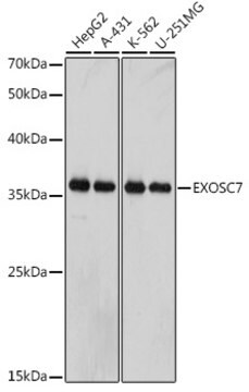 Anti-EXOSC7 Antibody, clone 0B8G6, Rabbit Monoclonal