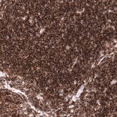 Monoclonal Anti-CD19 antibody produced in mouse Prestige Antibodies® Powered by Atlas Antibodies, clone CL15454, purified antibody (Protein A)