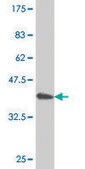 ANTI-TIE1 antibody produced in mouse clone 1G10, purified immunoglobulin, buffered aqueous solution