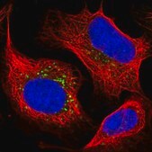 Anti-STK11IP antibody produced in rabbit Prestige Antibodies&#174; Powered by Atlas Antibodies, affinity isolated antibody, buffered aqueous glycerol solution