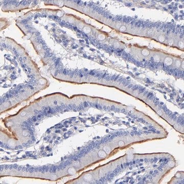 Anti-SLC44A2 antibody produced in rabbit Prestige Antibodies&#174; Powered by Atlas Antibodies, affinity isolated antibody, buffered aqueous glycerol solution