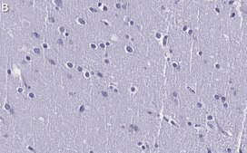 Anti-RhoB Antibody, clone 3M19 ZooMAb&#174; Rabbit Monoclonal recombinant, expressed in HEK 293 cells