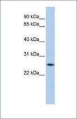 Anti-FTH1 antibody produced in rabbit affinity isolated antibody