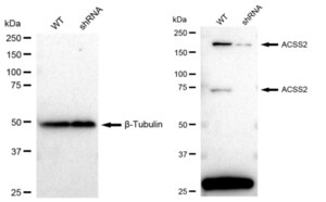 KD-Validated Anti ACSS2 Antibody, clone 23GB1705, Rabbit Monoclonal clone 23GB1705, recombinant rabbit monoclonal, expressed in HEK293 cells