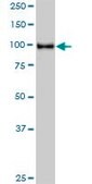 Monoclonal Anti-STAT6 antibody produced in mouse clone 4G7, purified immunoglobulin, buffered aqueous solution