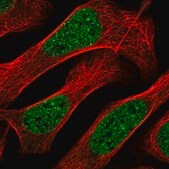 Anti-ZNF613 antibody produced in rabbit Prestige Antibodies® Powered by Atlas Antibodies, affinity isolated antibody, buffered aqueous glycerol solution