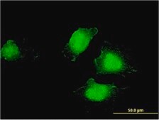 Monoclonal Anti-EDC4, (C-terminal) antibody produced in mouse clone 2E2, purified immunoglobulin, buffered aqueous solution