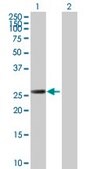 Anti-RAD51L3 antibody produced in mouse purified immunoglobulin, buffered aqueous solution