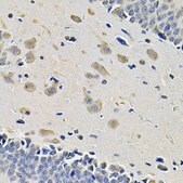 Anti-ITGA2 antibody produced in rabbit