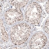 Monoclonal Anti-HDAC5 antibody produced in mouse Prestige Antibodies&#174; Powered by Atlas Antibodies, clone CL8121, purified immunoglobulin, buffered aqueous glycerol solution