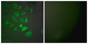 Anti-S100 A1, N-Terminal antibody produced in rabbit affinity isolated antibody