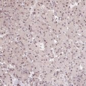 Anti-HMGN3 Prestige Antibodies® Powered by Atlas Antibodies, affinity isolated antibody