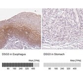 Anti-DSG3 antibody produced in rabbit Prestige Antibodies&#174; Powered by Atlas Antibodies, affinity isolated antibody, buffered aqueous glycerol solution