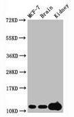 Anti-trimethyl-Histone H4 (K20) antibody, clone 1E6, Rabbit Monoclonal recombinant, expressed in HEK293F cells
