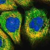 Anti-TEX9 antibody produced in rabbit Prestige Antibodies&#174; Powered by Atlas Antibodies, affinity isolated antibody, buffered aqueous glycerol solution