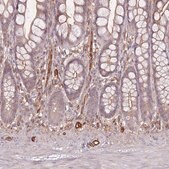 Anti-PLS3 antibody produced in rabbit Prestige Antibodies&#174; Powered by Atlas Antibodies, affinity isolated antibody, buffered aqueous glycerol solution