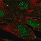 Anti-LHX9 antibody produced in rabbit Prestige Antibodies&#174; Powered by Atlas Antibodies, affinity isolated antibody, buffered aqueous glycerol solution