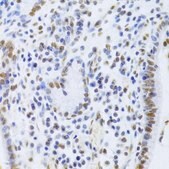 Anti-XRCC5 antibody produced in rabbit