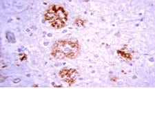 Anti-Beta-Amyloid 1-42 Antibody Chemicon&#174;, from rabbit